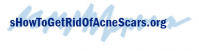 Acne Scar Removal