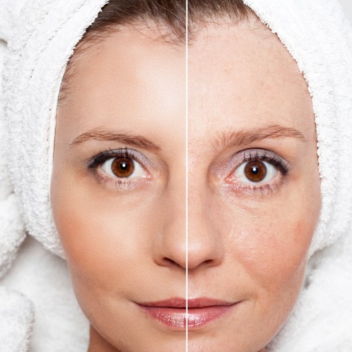 Skin Tightening Treatments on the Rise