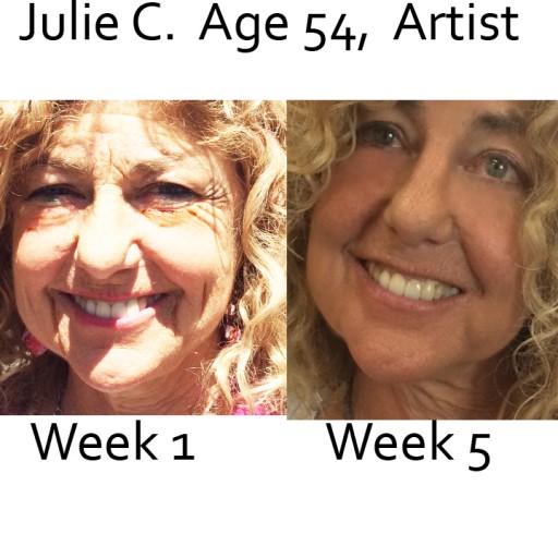 Doctors Suggesting Unprecedented Organic Products Over Prescription Retinol for Best Anti-Aging Results