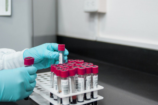 High Demand for Plastics in Medical Sector Driving Demand for Injection Molding