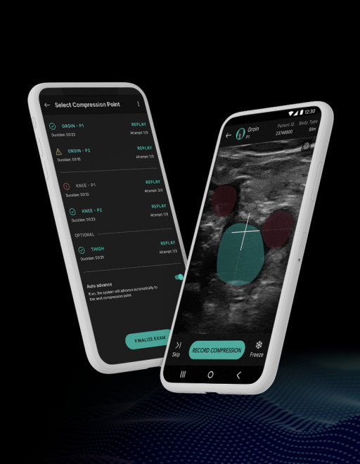 ThinkSono Secures Additional £4.5M / $6Mn Funding, Expands Team and Operations Across the UK, EU and U.S.