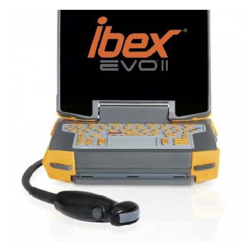 E.I. Medical Imaging Announces the Release of EVO® II Portable Ultrasound System