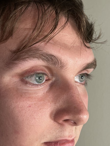 The artificial right eye, shown on the left,