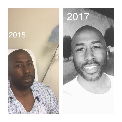 1 in 6 African American Men Will Get Prostate Cancer