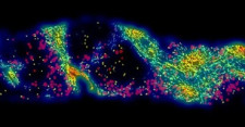 FibroNest digital pathology in liver biopsies from patients with MASH