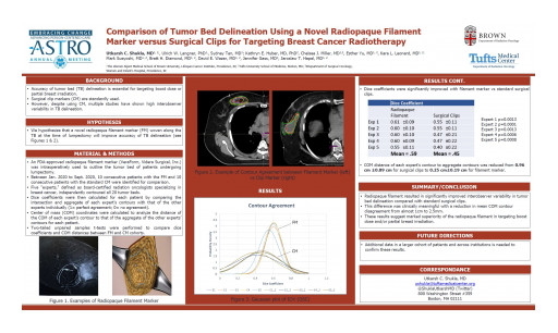 Study Demonstrates Superiority of VeraForm® Marker Over Clips  for Tumor Bed Delineation Accuracy